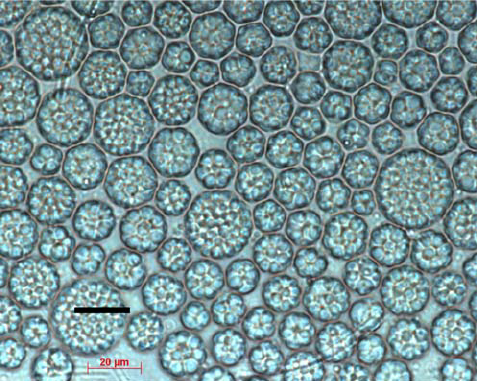 Epifluorescence-microscopy-of-cells-of-Schizochytrium-sp-stained-with-Nile-blue-and Epifluorescence-microscopy-of-cells-of-Schizochytrium-sp-stained-with-Nile-blue-and