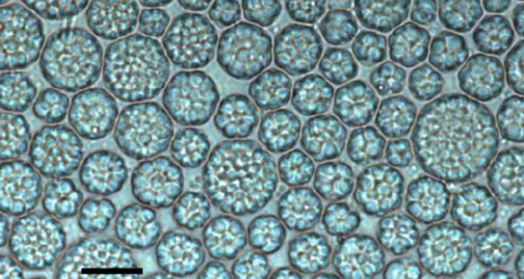 Epifluorescence-microscopy-of-cells-of-Schizochytrium-sp-stained-with-Nile-blue-and