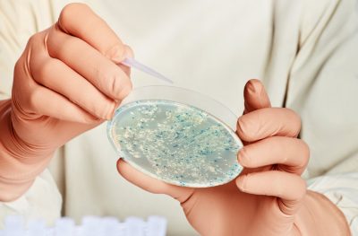 APROMAR saca a concurso un proyecto para desarrollar vacunas para Pasteurelosis en lubina europea