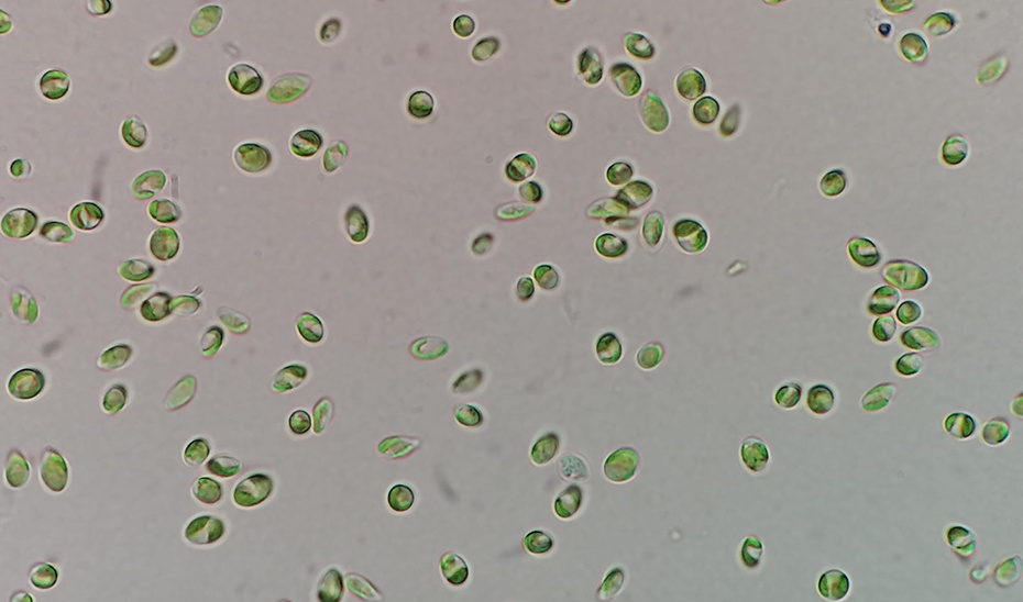 Coccomyxa onubensis, microalga Río Tinto, Huelva Coccomyxa onubensis, microalga Río Tinto, Huelva