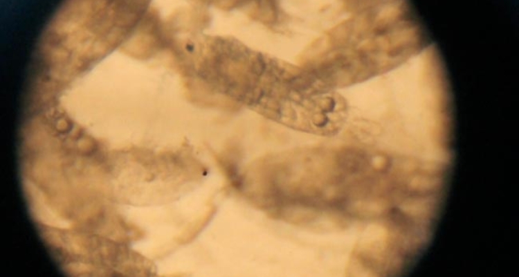 copepodos-microscopio