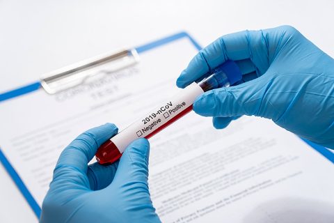 Coronavirus COVID-19