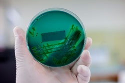 Prueban una terapia con fagos para combatir la enfermedad bacteriana del agua fría en trucha arcoíris