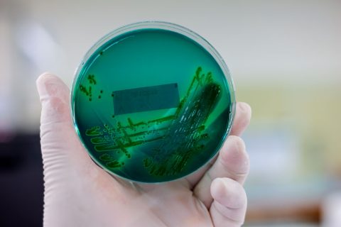 cultivo-bacteria-escherichia-coli-760