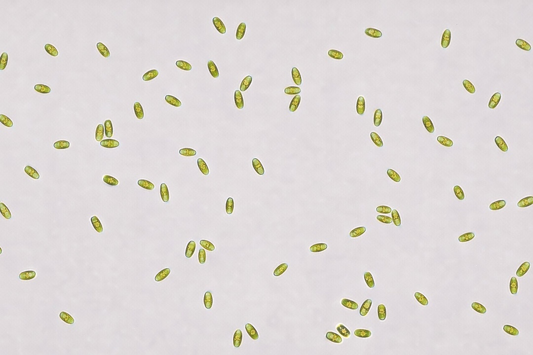 Diatomea Sellaphora minima