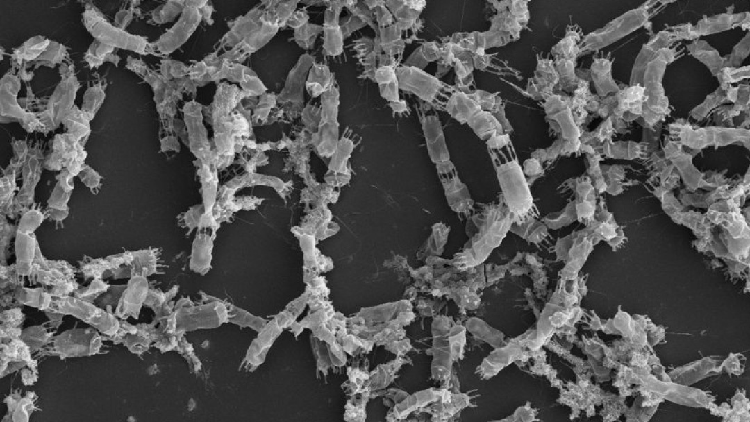 microalgas diatomeas al microscópio
