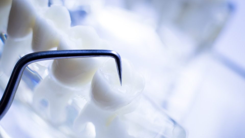 Diente en dentista