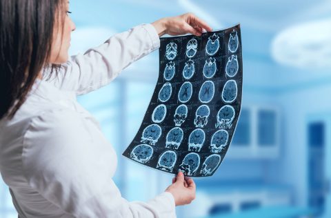Doctora radiografía cerebro