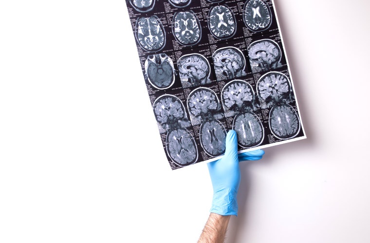 Escaner cerebro médico Escaner cerebro médico