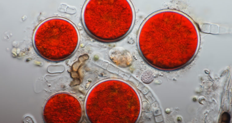 Haematococcus pluvialis al microscópio Haematococcus pluvialis al microscópio