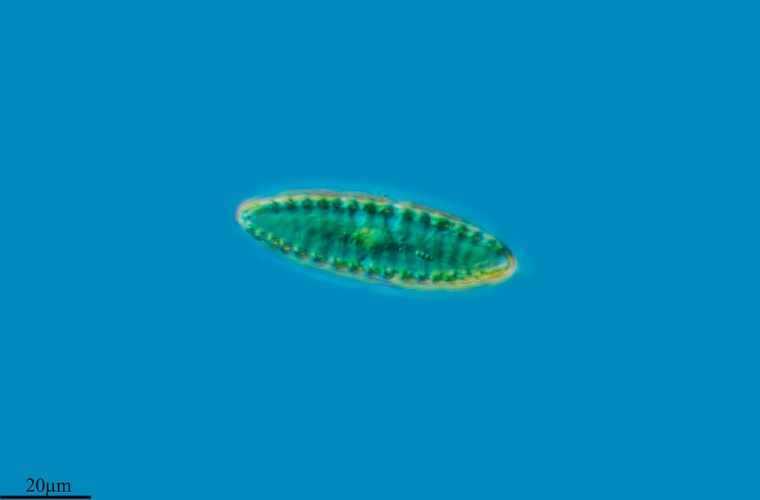 Microalga diatomea Microalga diatomea