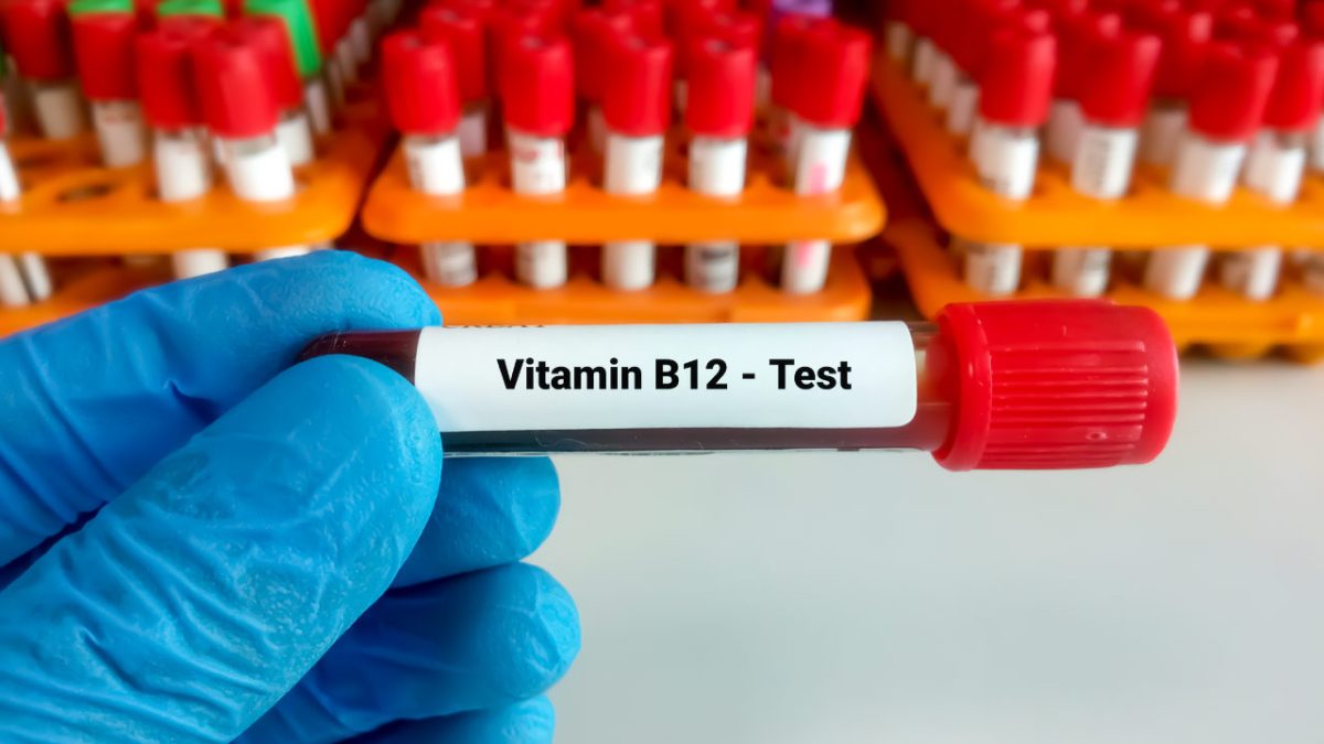 test de sangre vitamina B12