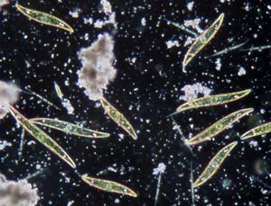 diatomea_pleurosigma_veta_la_palma