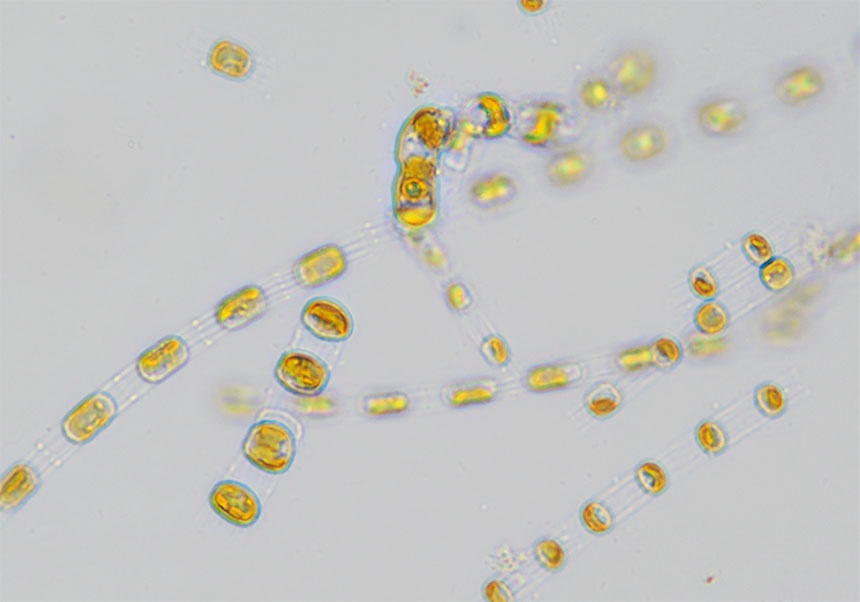 Diatomea Skeletonema marinoi Diatomea Skeletonema marinoi