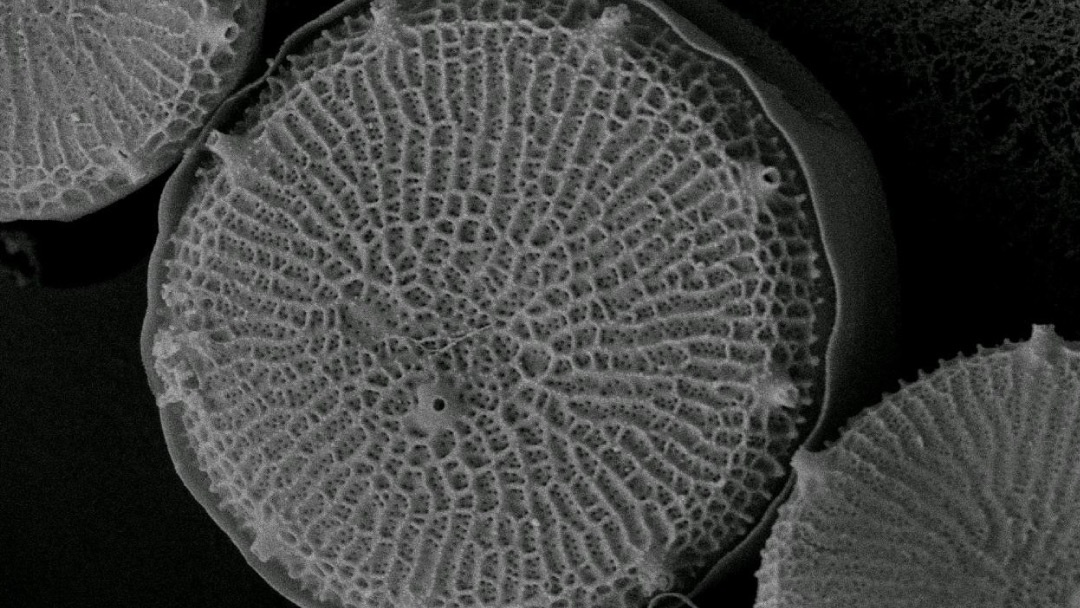 microalga vista al microscopio microalga vista al microscopio