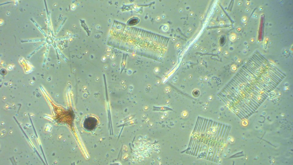 Microalgas de agua dulce al microscópio